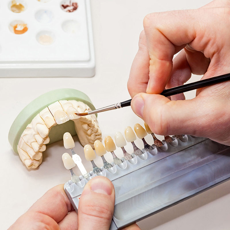 Ästhetische-Zahnmedizin
